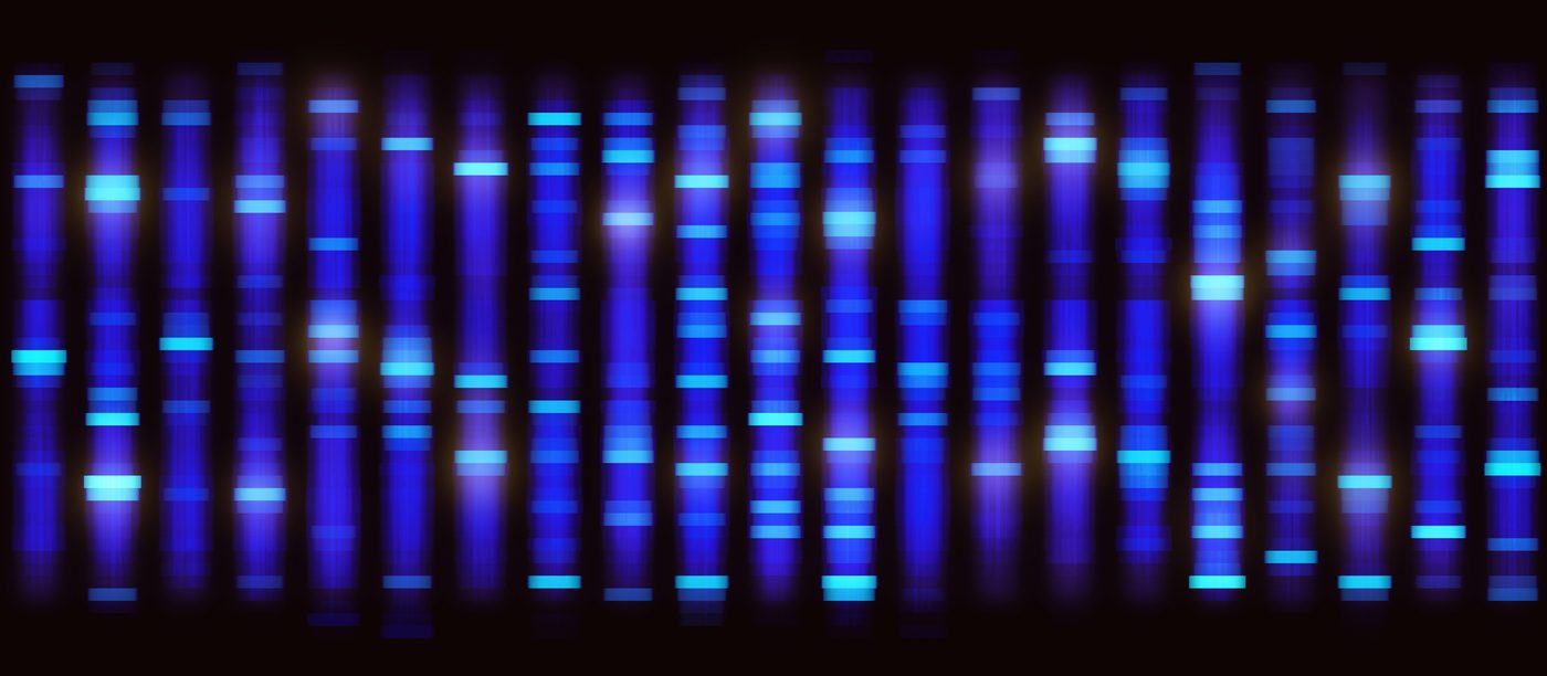 Fluorescent gel electrophoresis bands showing DNA separation in genetic research
